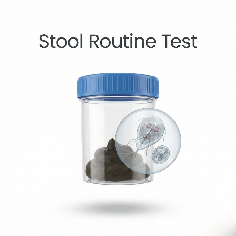 Stool Routine Container stool routine examination test in Seawoods
